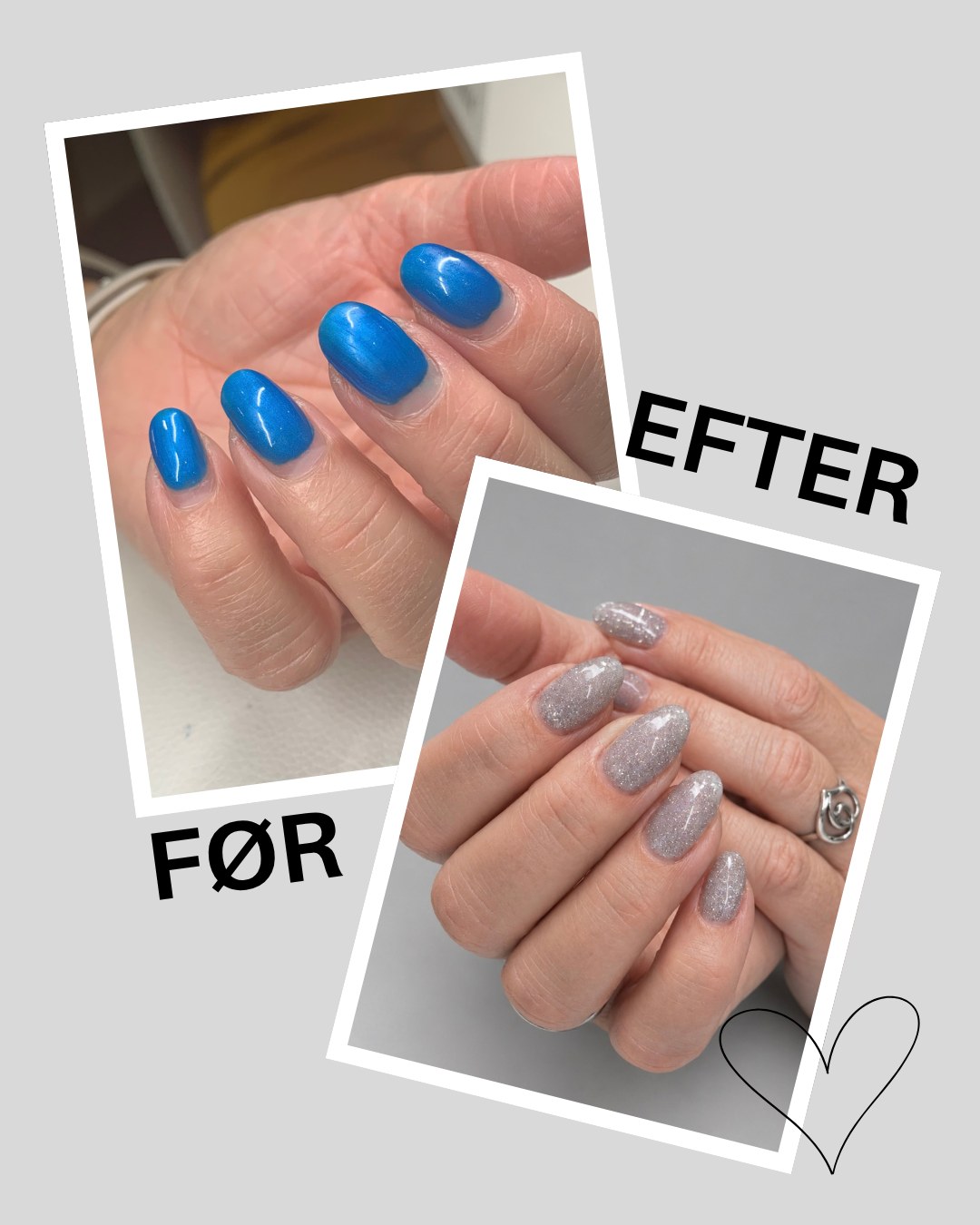 Et lille før & efter ✨
Fra blå til sølv – og fra udvoksede negle til et helt nyt, frisk look. 🤍
Jeg elsker, hvor stor en forskel en ny behandling kan gøre. ✨